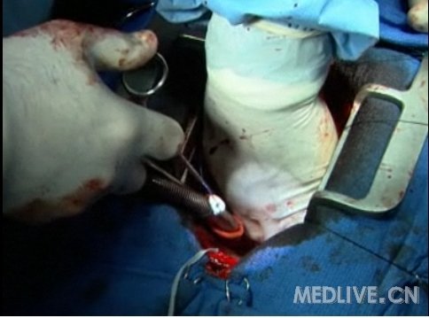http://webres.medlive.cn/upload/000/050/461