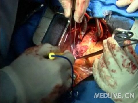 http://webres.medlive.cn/upload/000/050/463