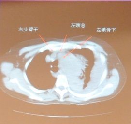 http://webres.medlive.cn/upload/000/051/770