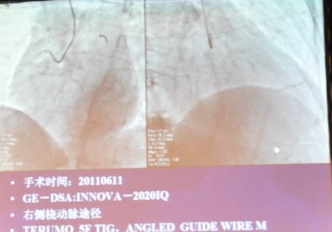 http://webres.medlive.cn/upload/000/051/771