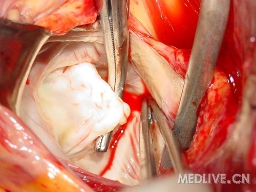 http://webres.medlive.cn/upload/000/053/141