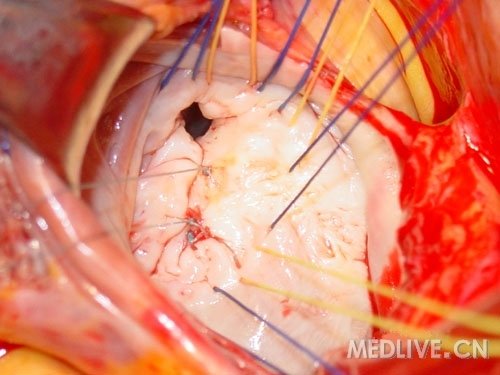 http://webres.medlive.cn/upload/000/053/143