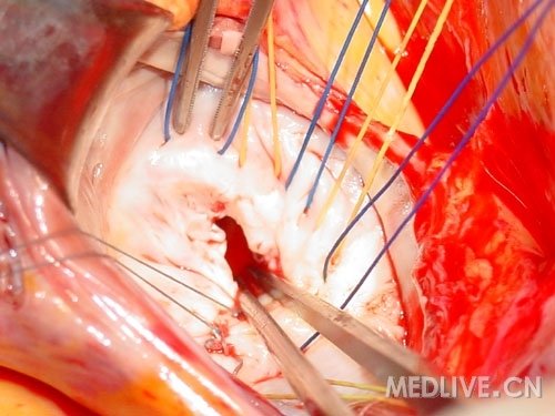 http://webres.medlive.cn/upload/000/053/144