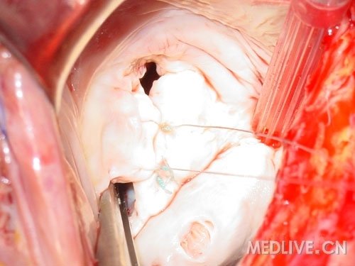 http://webres.medlive.cn/upload/000/053/146
