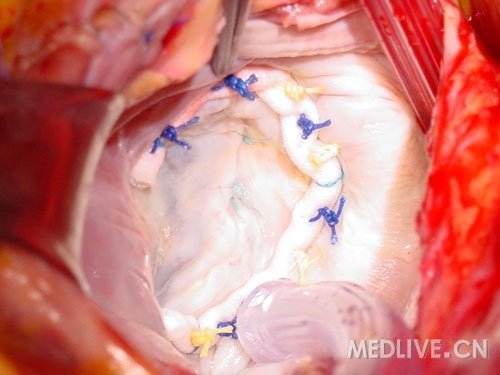 http://webres.medlive.cn/upload/000/053/149