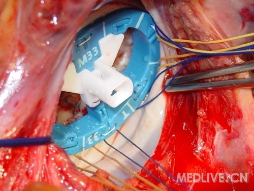 http://webres.medlive.cn/upload/000/053/952