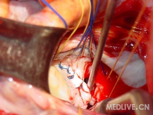 http://webres.medlive.cn/upload/000/053/961