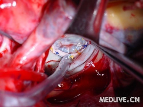 http://webres.medlive.cn/upload/000/053/979