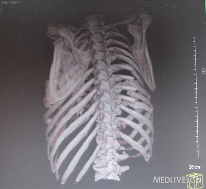 http://webres.medlive.cn/upload/000/055/936