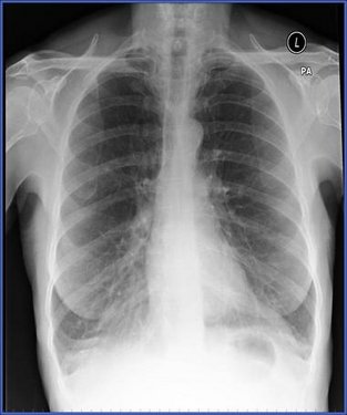 http://webres.medlive.cn/upload/000/056/714