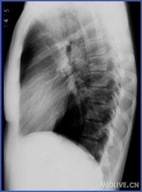 http://webres.medlive.cn/upload/000/056/716