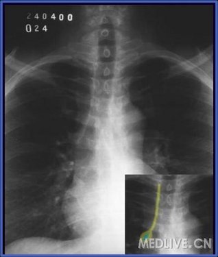 http://webres.medlive.cn/upload/000/056/719