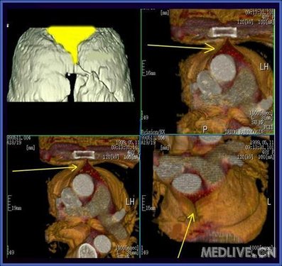 http://webres.medlive.cn/upload/000/056/730