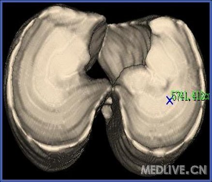 http://webres.medlive.cn/upload/000/056/740