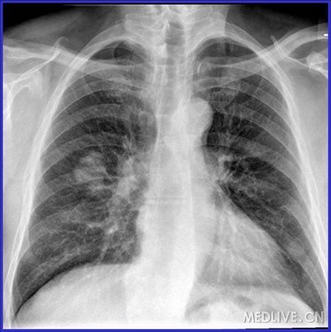 http://webres.medlive.cn/upload/000/056/750
