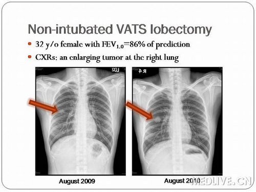 http://webres.medlive.cn/upload/000/058/171