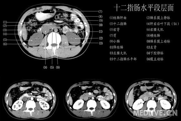 http://webres.medlive.cn/upload/000/060/563