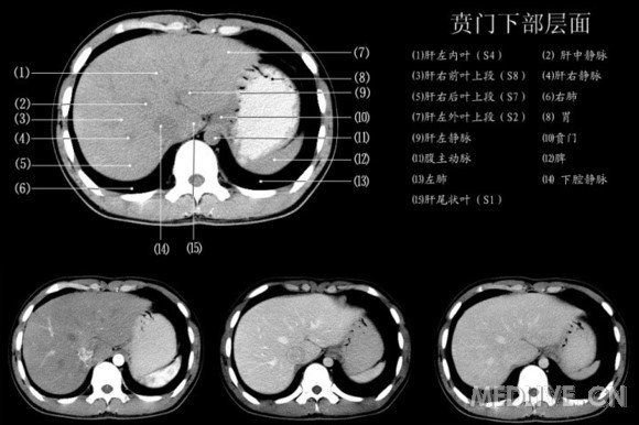 http://webres.medlive.cn/upload/000/060/564