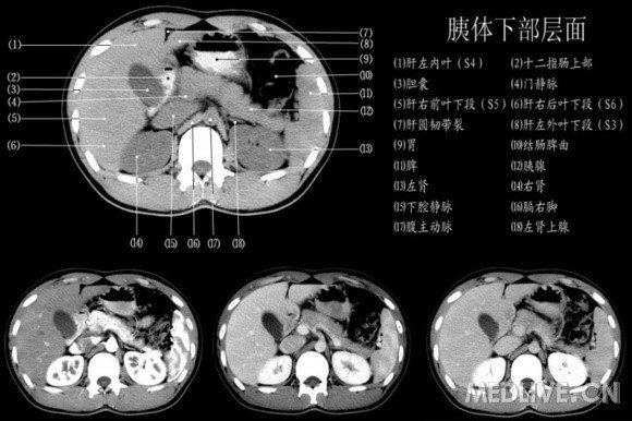 http://webres.medlive.cn/upload/000/060/565