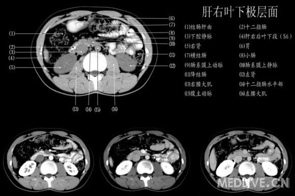 http://webres.medlive.cn/upload/000/060/566