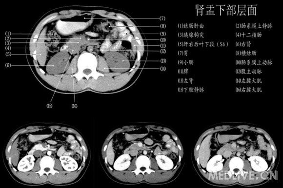 http://webres.medlive.cn/upload/000/060/570