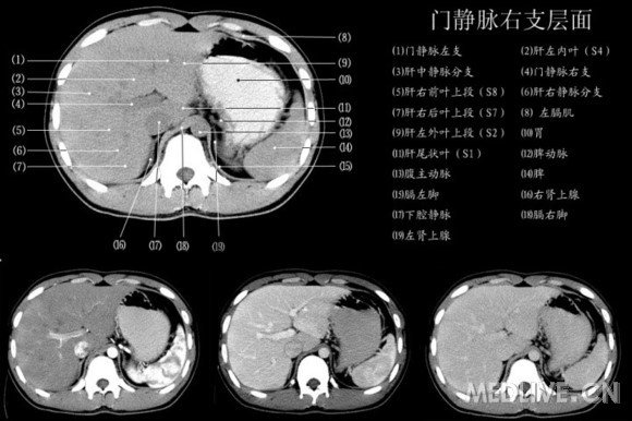 http://webres.medlive.cn/upload/000/060/571