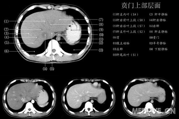 http://webres.medlive.cn/upload/000/060/572