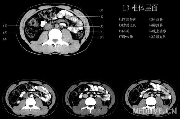 http://webres.medlive.cn/upload/000/060/575