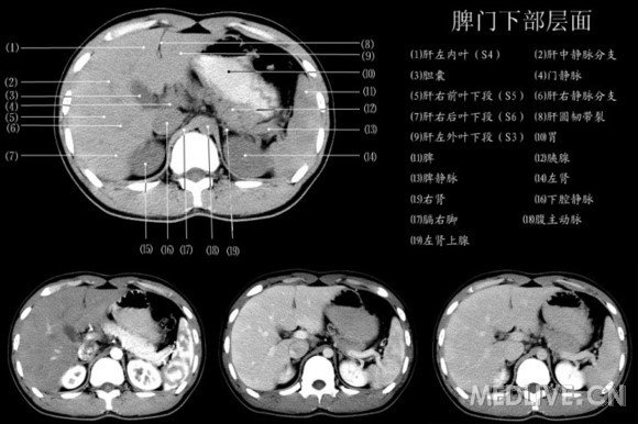 http://webres.medlive.cn/upload/000/060/576