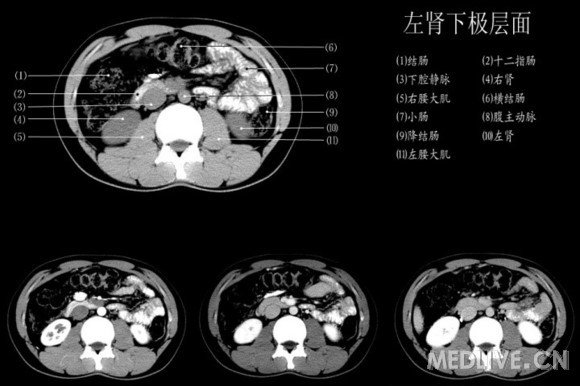 http://webres.medlive.cn/upload/000/060/577