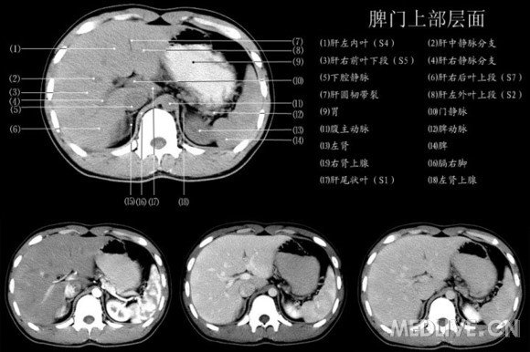 http://webres.medlive.cn/upload/000/060/581