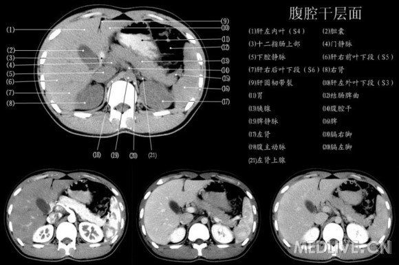 http://webres.medlive.cn/upload/000/060/582