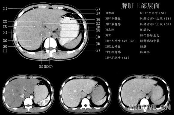 http://webres.medlive.cn/upload/000/060/584