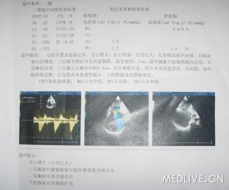http://webres.medlive.cn/upload/000/060/738