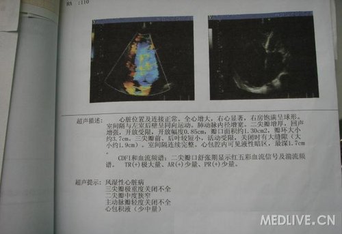 http://webres.medlive.cn/upload/000/060/754