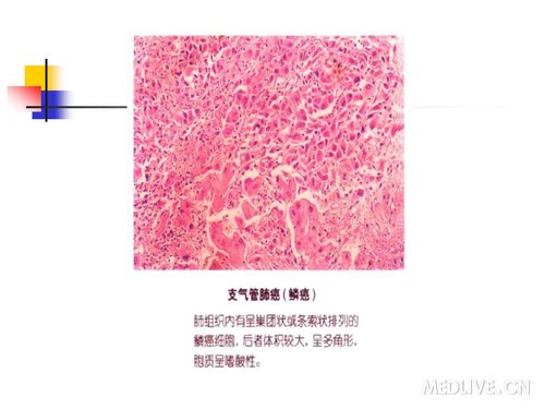 http://webres.medlive.cn/upload/000/061/028