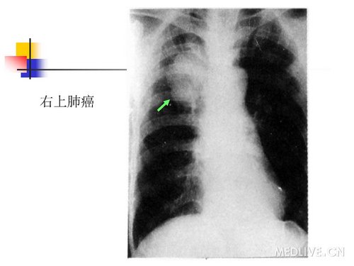 http://webres.medlive.cn/upload/000/061/029