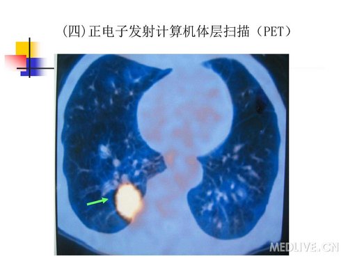 http://webres.medlive.cn/upload/000/061/030