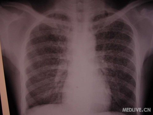 http://webres.medlive.cn/upload/000/061/076