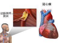 http://webres.medlive.cn/upload/000/066/952