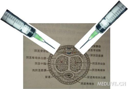 http://webres.medlive.cn/upload/000/067/399