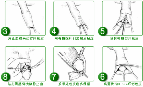 http://webres.medlive.cn/upload/000/067/400