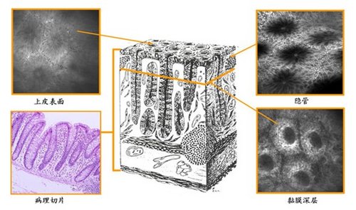 内镜新技术--PENTAX激光共聚焦显微内镜(图)