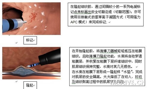 http://webres.medlive.cn/upload/000/067/996