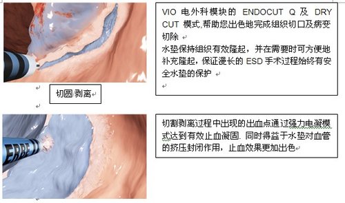 http://webres.medlive.cn/upload/000/067/997