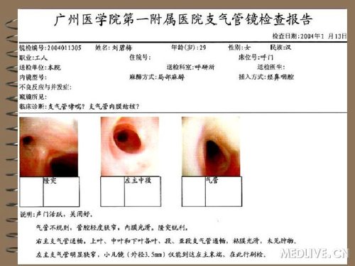 http://webres.medlive.cn/upload/000/078/577