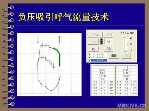 http://webres.medlive.cn/upload/000/078/627