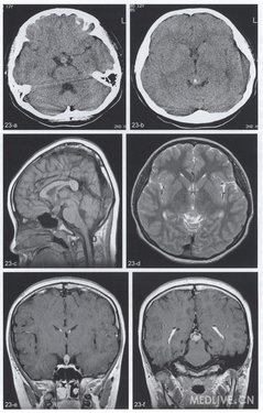 http://webres.medlive.cn/upload/000/078/821