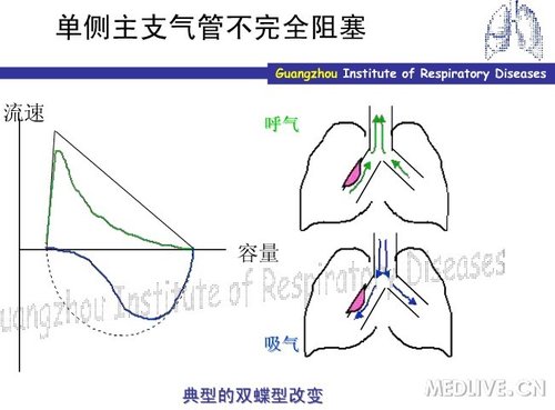 http://webres.medlive.cn/upload/000/078/872