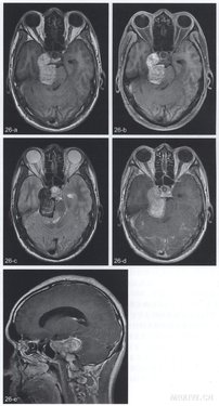http://webres.medlive.cn/upload/000/078/886